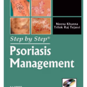 Step By Step Psoriasis Management With Photo Cd-Rom