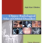 Clinico-Radiological Atlas Of Orbital Disorders