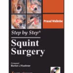 Step By Step Squint Surgery