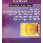 Manual Of Intrauterine Insemination(Iui)In Vitro Fertilization(Ivf)&Intracytoplasmic Sperm Inj.(Icsi