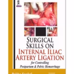 Surgical Skills On Internal Iliac Artery Ligation:For Controlling Postpartum & Pelvic Hemorrhage