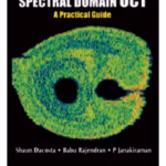 Spectral Domain Oct A Practical Guide