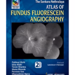 The Sankara Nethralaya Atlas Of Fundus Fluorescein Angiography With Photo Dvd-Rom