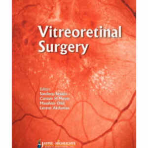 Vitreoretinal Surgery