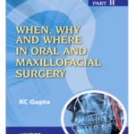 When,Why And Where In Oral And Maxillofacial Surgery Part Ii