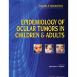 Epidemiology Of Ocular Tumors In Children & Adults