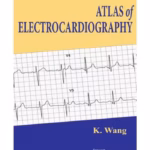 Atlas Of Electrocardiography