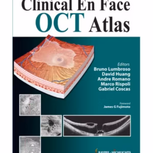 Clinical En Face Oct Atlas