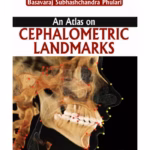 An Atlas On Cephalometric Landmarks