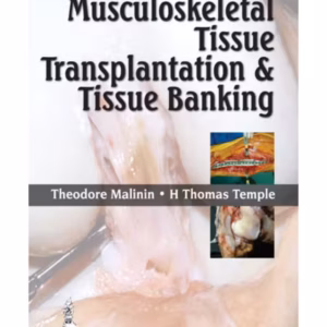 Musculoskeletal Tissue Transplantation & Tissue Banking
