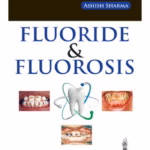 Fluoride & Fluorosis