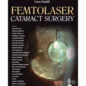 Femtolaser Cataract Surgery