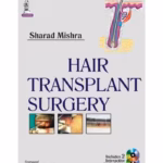 Hair Transplant Surgery
