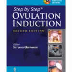 Step By Step Ovulation Induction With Cd-Rom