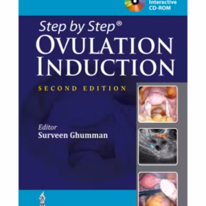 Step By Step Ovulation Induction With Cd-Rom