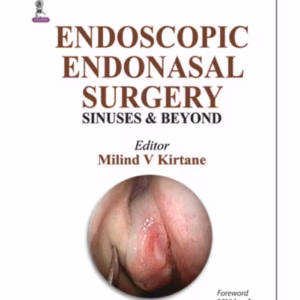 Endoscopic Endonasal Surgery Sinuses & Beyond