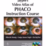 Jaypee'S Video Atlas Of Phaco Instruction Course On Dvd Free With Instuction Course Book