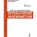 Infertility Management Series:Intrauterine Insemination