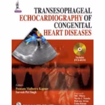 Transesophageal Echocardiography Of Congenital Heart Diseases