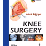 Knee Surgery Includes Dvd-Rom