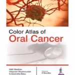 Color Atlas Of Oral Cancer