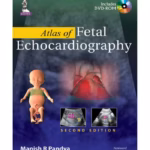 Atlas Of Fetal Echocardiography