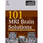 101 Mri Brain Solutions