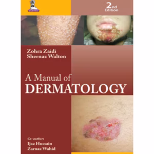 A Manual Of Dermatology