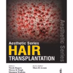 Aesthetic Series:Hair Transplantation