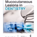 Mucocutaneous Lesions In Dentistry