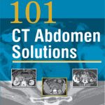 101 Ct Abdomen Solutions