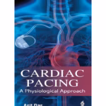 Cardiac Pacing A Physiological Approach