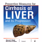 Preventive Measures For Cirrhosis Of Liver And Its Progression