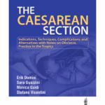 The Caesarean Seciton