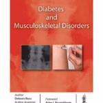 Diabetes And Musculoskeletal Disorders
