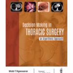 Decision Making In Thoracic Surgery An Algorithmic Approach