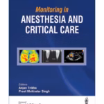 Monitoring In Anesthesia And Critical Care