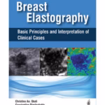 Breast Elastography Basic Principles And Interpretation Of Clinical Cases