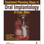 Treatment Planning Steps In Oral Implantology:A Color Atlas