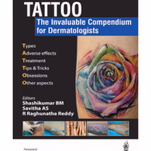 Tattoo:The Invaluable Compendium For Dermatologists