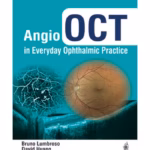 Angio Oct In Everyday Ophthalmic Practice