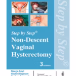 Step By Step Non-Descent Vaginal Hysterectomy