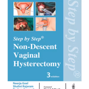 Step By Step Non-Descent Vaginal Hysterectomy