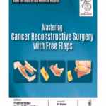 Mastering Cancer Reconstructive Surgery With Free Flaps