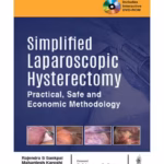 Simplified Laparoscopic Hysterectomy Practical, Safe And Economic Methodology With Dvd-Rom