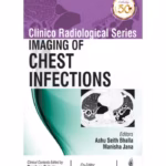 Clinico Radiological Series Imaging Of Chest Infections