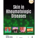 Skin In Rheumatologic Diseases