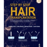 Step By Step Hair Transplantation