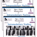 Tips & Tricks Masterclass Of Intramedullary Nailing (3 Volumes): Based On A Course Accredited By The