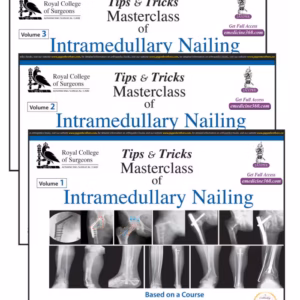 Tips & Tricks Masterclass Of Intramedullary Nailing (3 Volumes): Based On A Course Accredited By The